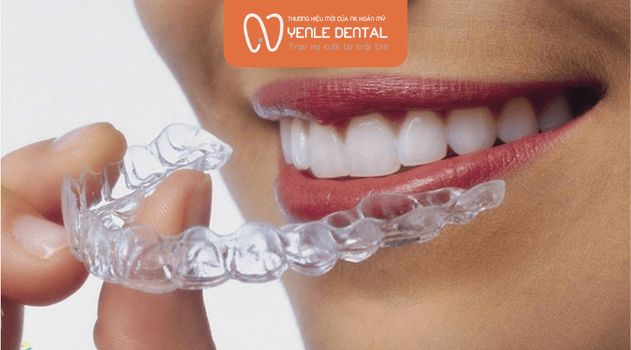 giá niềng răng invisalign